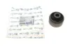 Сайлентблок важеля (переднього/знизу/спереду) Ford Galaxy/Mondeo 06-15 714 610 0011