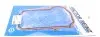 Прокладка поддона Audi A4/A6/VW Passat 1.8 95-01 VICTOR REINZ 71-31956-00 (фото 2)